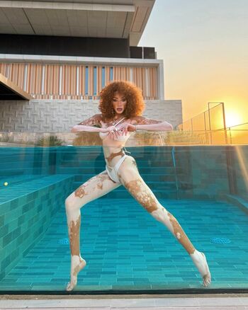 Full leaked Winnie harlow page private onlyfans photo