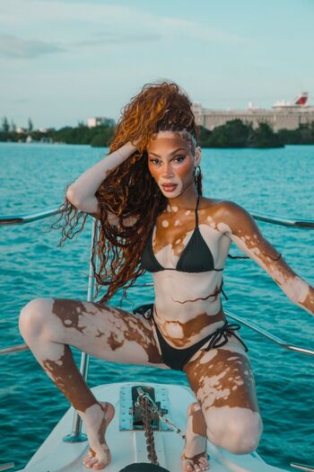 Full leaked Winnie harlow page private onlyfans photo