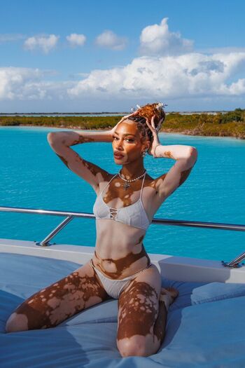 Full leaked Winnie harlow page private onlyfans photo