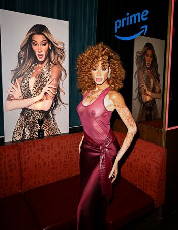 Full leaked Winnie harlow page private onlyfans photo