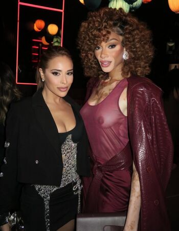 Full leaked Winnie harlow page private onlyfans photo