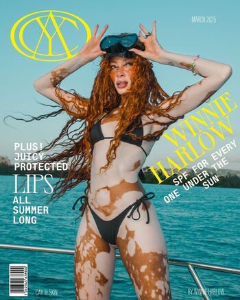 Full leaked Winnie harlow page private onlyfans photo
