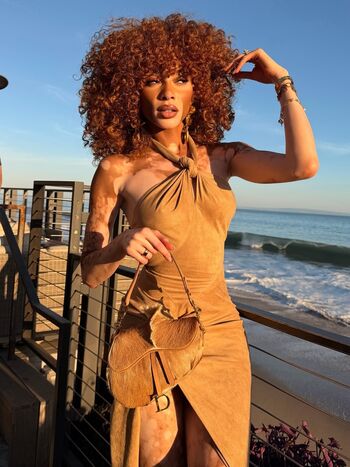 Full leaked Winnie harlow private onlyfans photo