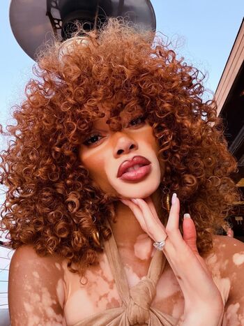 Full leaked Winnie harlow private onlyfans photo